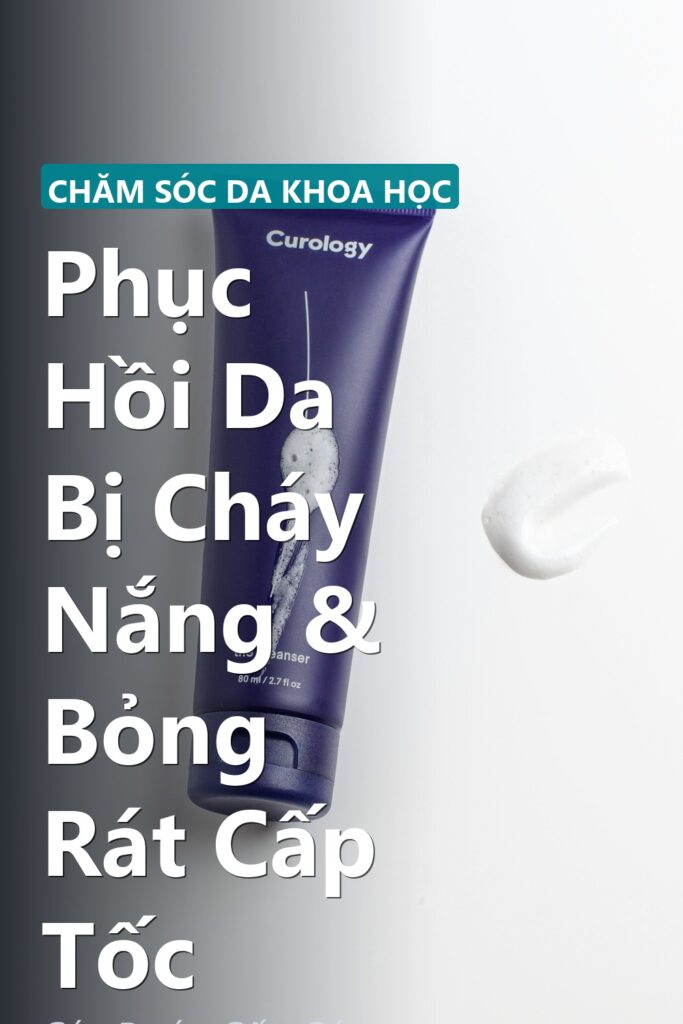 Phục Hồi Da Bị Cháy Nắng & Bỏng Rát Cấp Tốc ảnh bìa tạp chí phong cách Linh Chi Vibes