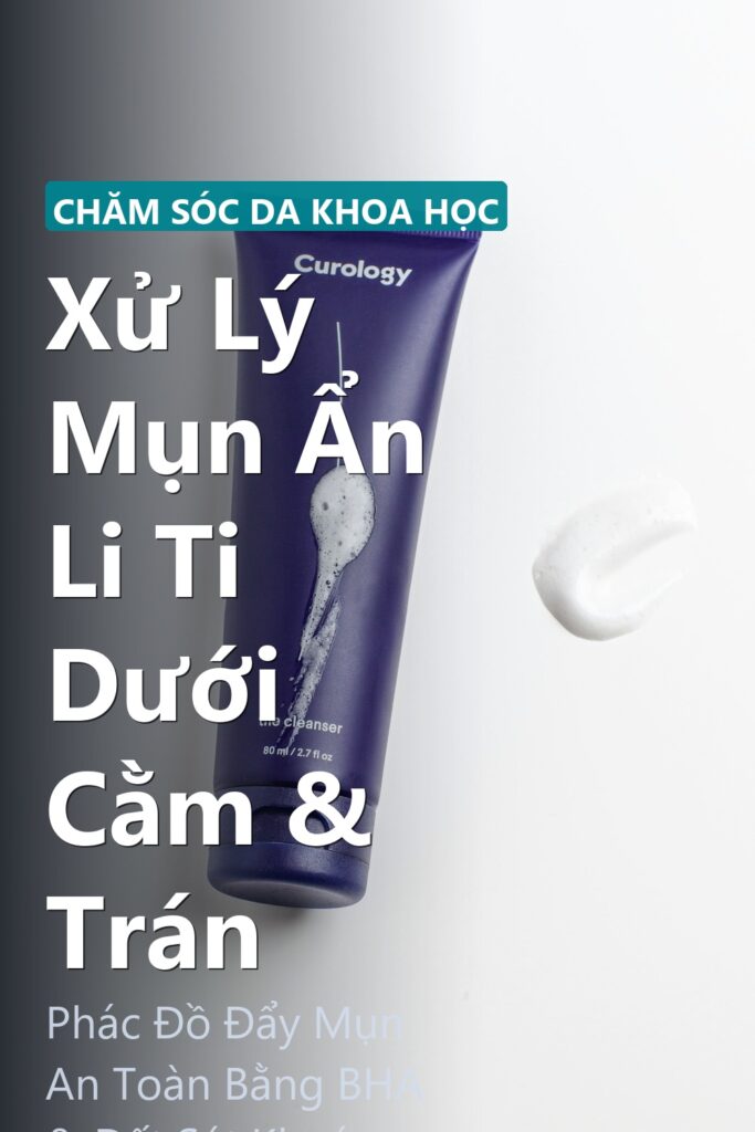 Xử Lý Mụn Ẩn Li Ti Dưới Cằm & Trán ảnh bìa tạp chí phong cách Linh Chi Vibes